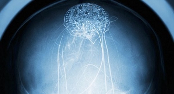 Уникальный имплантат  восстанавливает связи в головном мозге