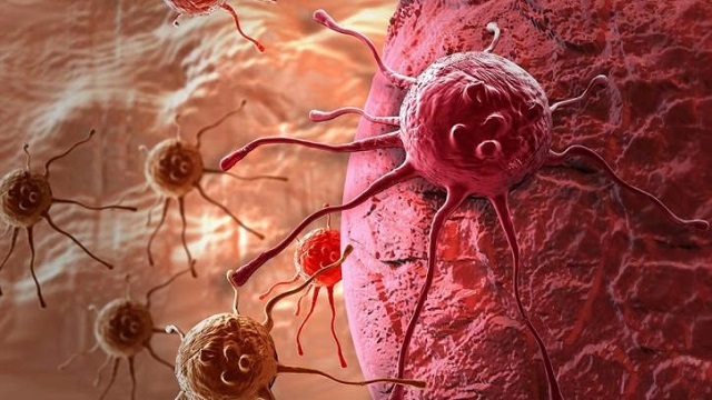 Новый гель призван бороться  против повторного роста раковых клеток
