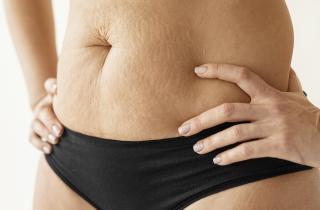 Совершенство устало быть красивым: как асимметрия тела стала символом внутренней гармонии