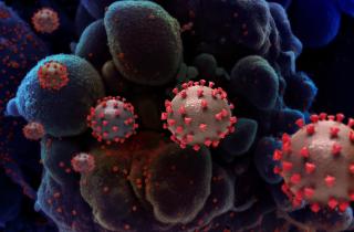 Постковидный синдром сопровождается хронической усталостью