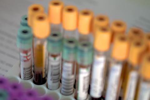 Учёные нашли способ увидеть усталость в крови — точность 92%