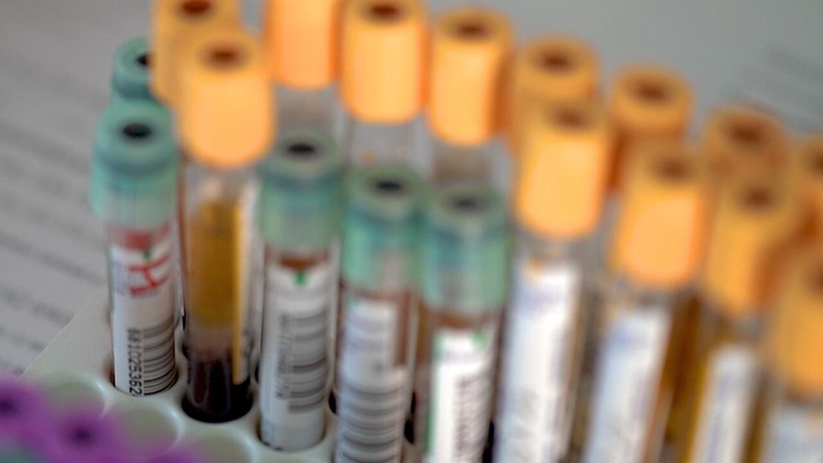 Пробирки с венозной кровью для исследования