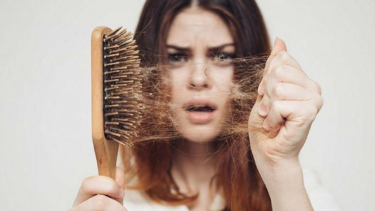 Выпадение волос