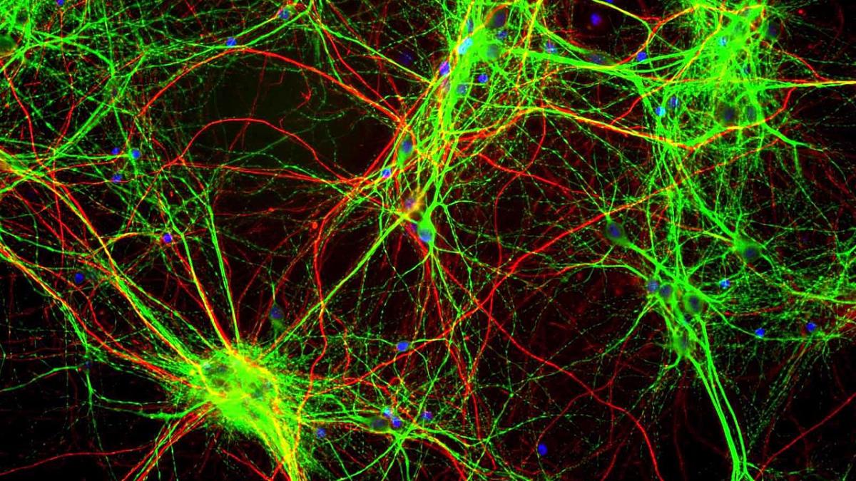 Клетки головного мозга