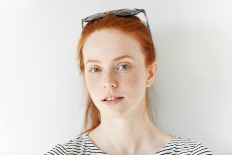 Лето рисует пятнышки: почему веснушки больше не маскируют