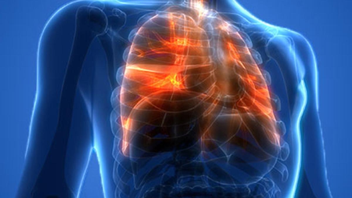 Больные лёгкие