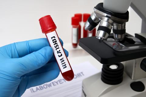 Врач объяснила, почему на самом деле важно сдавать анализы натощак