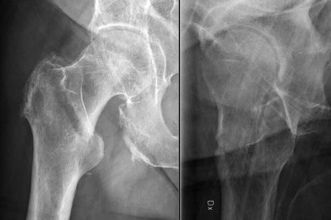 Отвлечение на телефон повышает риск бытовых падений — Марк Морокко