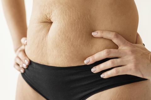 Эксперты: движение body neutrality меняет отношение к спорту и внешности