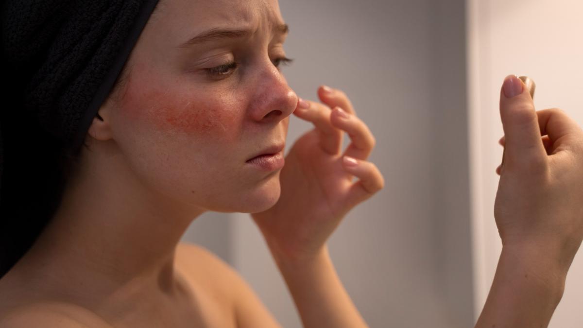 Девушка с аллергией