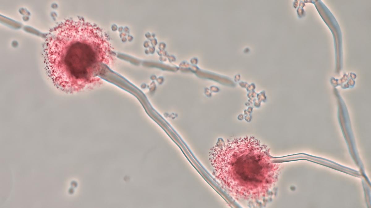 Микроскопическая фотография гриба Aspergillus Микроскопическая фотография гриба Aspergillus