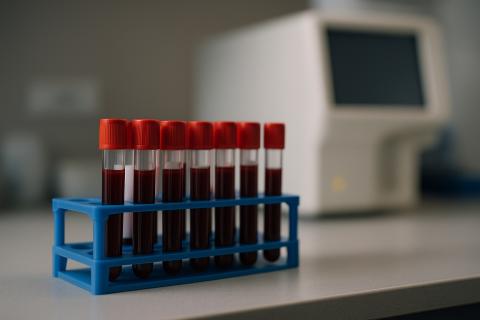 Учёные из Йельского университета создали тест, оценивающий состояние иммунной системы