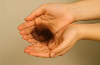 Анемия вызывает патологическое выпадение волос — Александр Мясников, врач