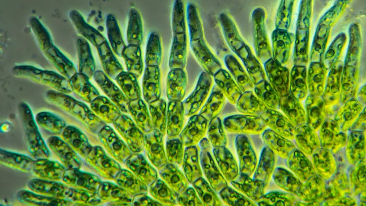 микроскопические водоросли микроскопические водоросли
