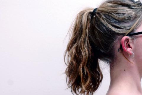 Энергетики провоцируют алопецию у подростков — Каменева, дерматолог