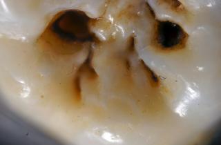 Учёные перевернули привычки: как зубы, рис и переписка спасают сердце и психику