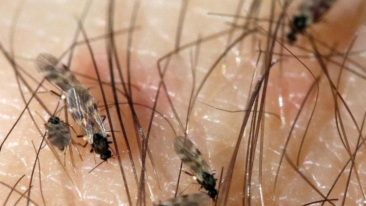 Мошки на коже человека